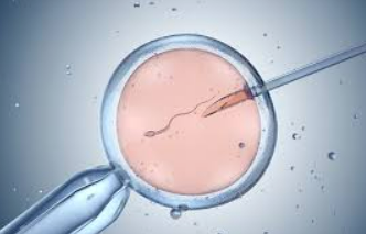 ICSI (Intracytoplasmic Sperm Injection)