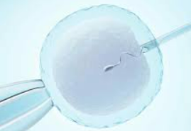 IMSI (Intracytoplasmic Morphologically Selected Sperm Injection)