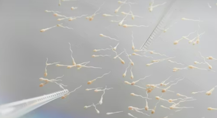 IVF (In Vitro Fertilization)