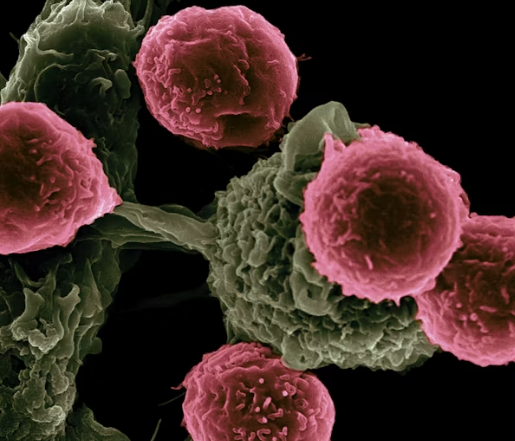 Gynecological Cancer Screening